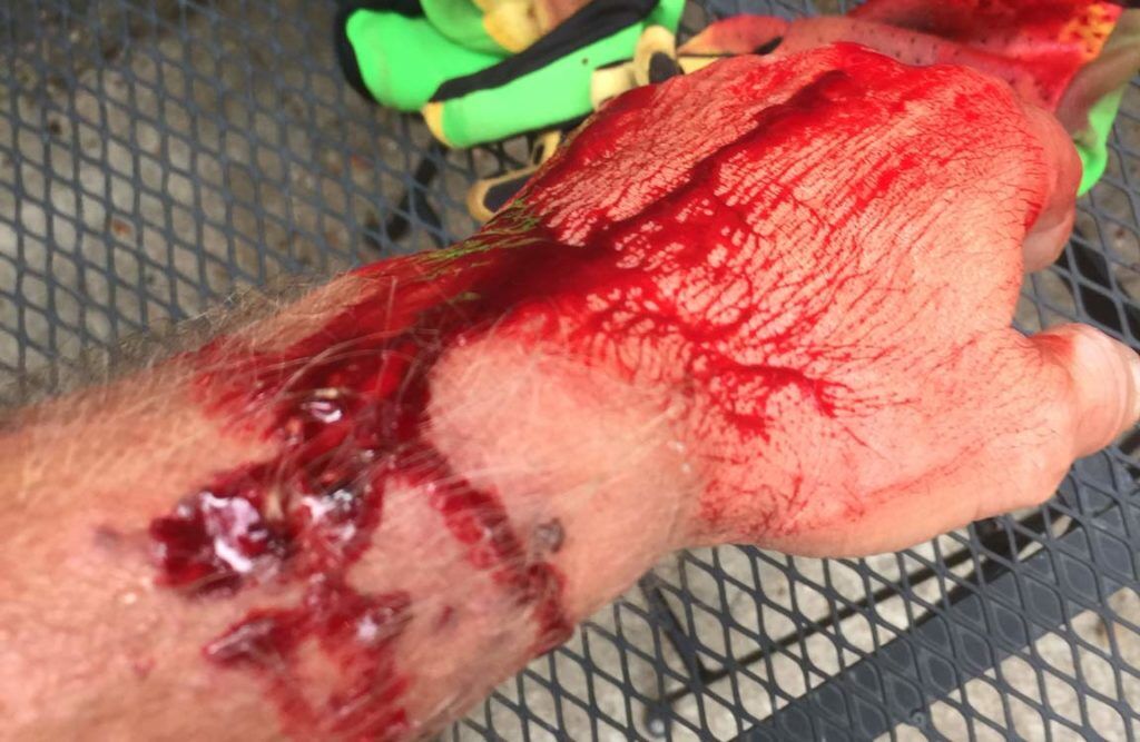 carmichael bloody arm
