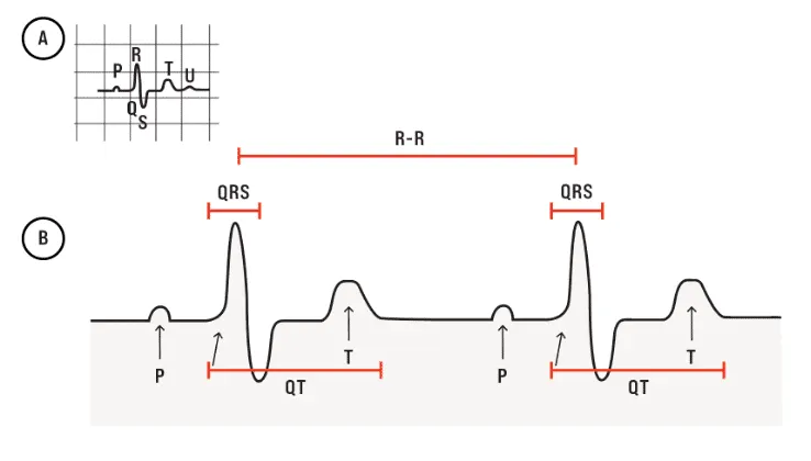 HRV graphic