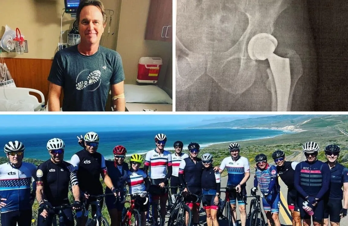 The Hip Replacement Training Plan: Returning to Cycling and Sport after Total Hip Arthroplasty 8 hip replacement