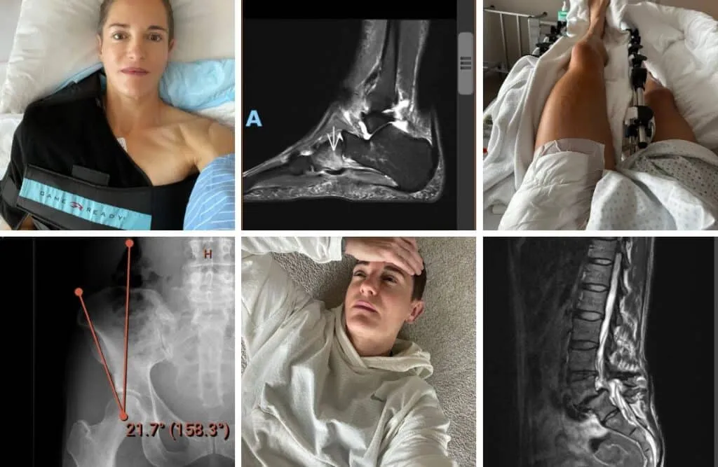 The TOR330 Project: Preparing for Tor des Géants, Europe's Hardest Ultramarathon 5 Corina Sommer injuries