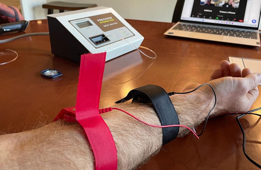 Sweat Testing for Athletes: What it is and how it can help your performance 3 inducing sweat with electricity for sweat test
