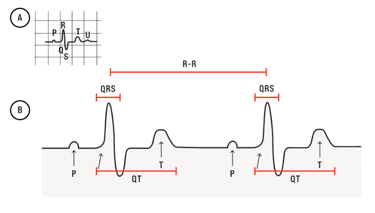 Practical Heart Rate Variability Recommendations for Ultrarunners 2 HRV graphic