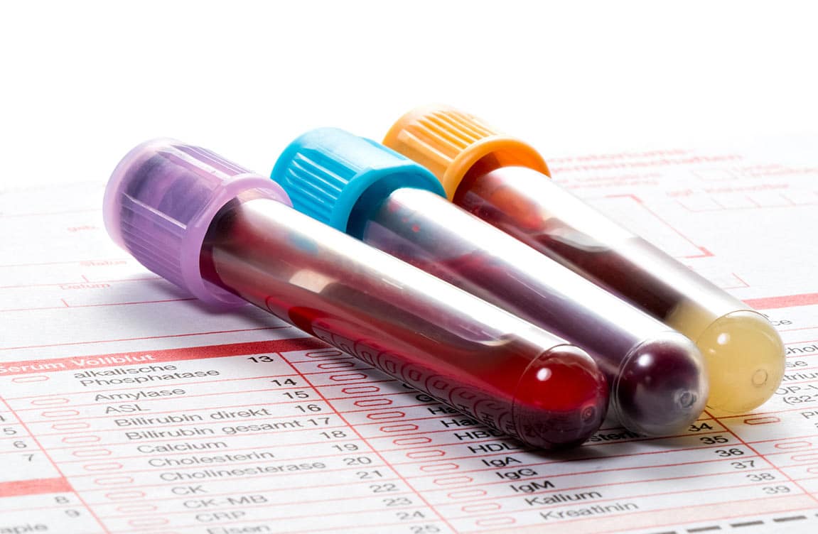 blood biomarkers